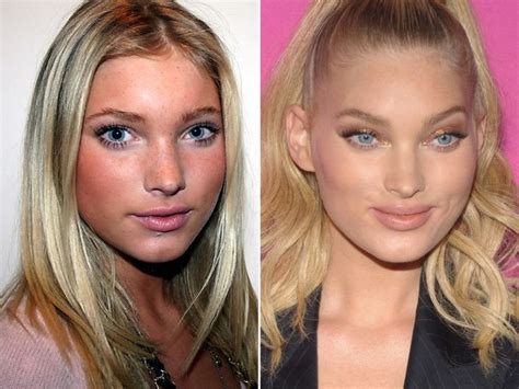 elsa hosk before and after|More.